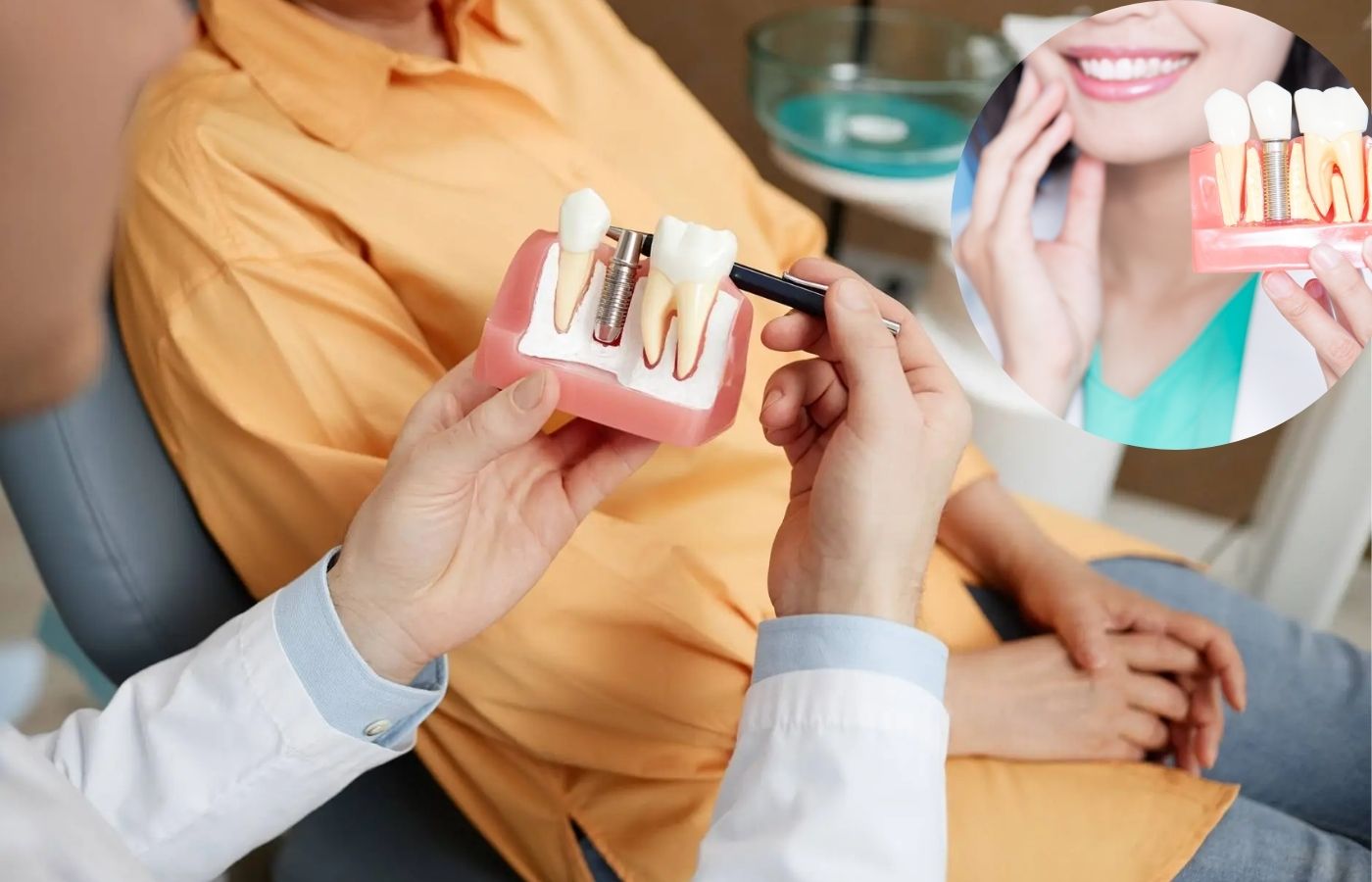 Dental implants in tooth replacement